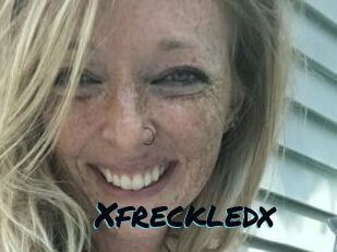 Xfreckledx